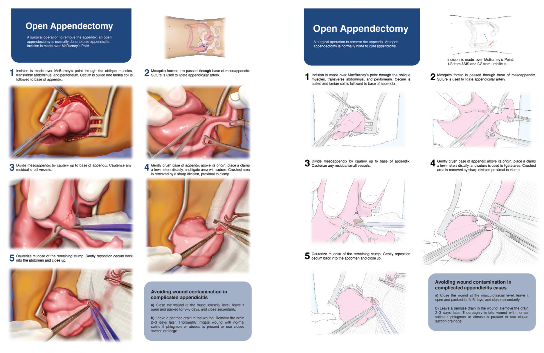 Medical Legal Case – Adobe Photoshop, Illustrator; Rochester Institute of Technology Medical Illustration; Medical Illustrator Puerto Rico